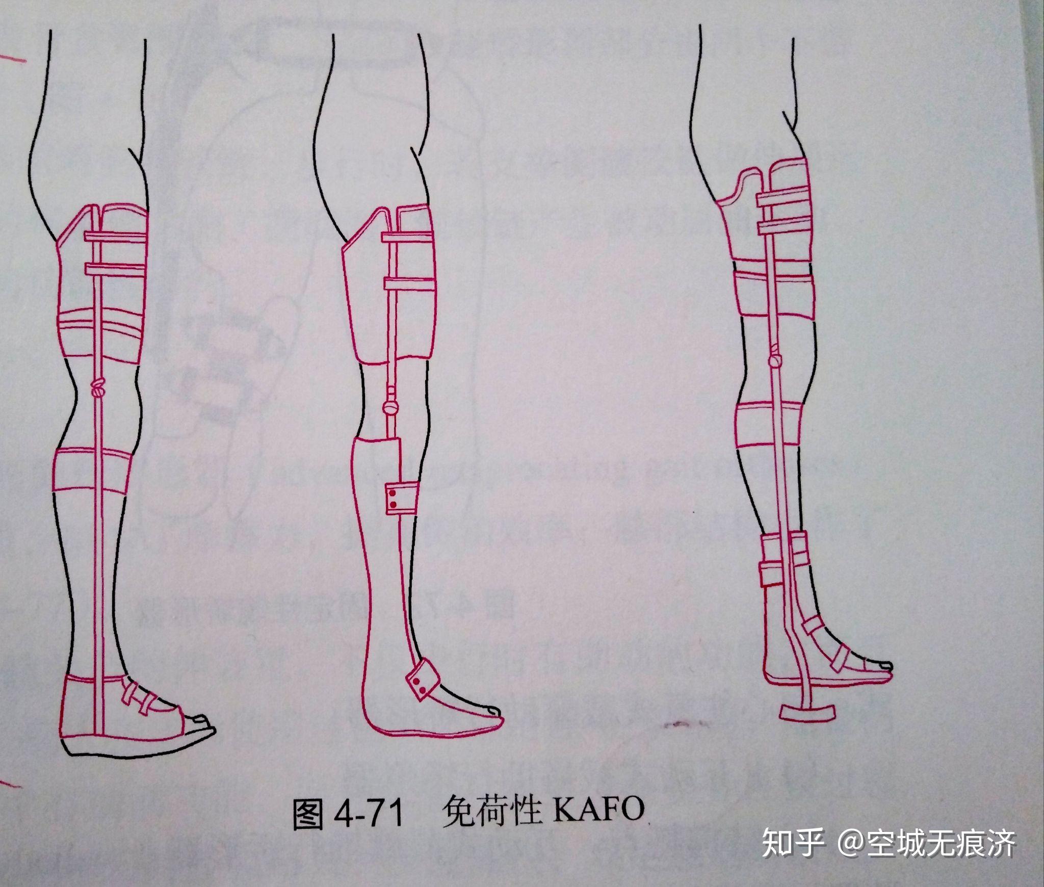 臨床康復工程學 假肢與矯形器的功能、設計與發展